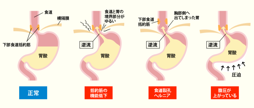 風邪やその他の感染症