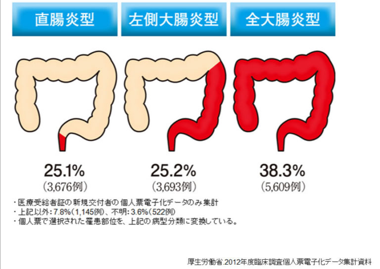 潰瘍性大腸炎（かいようせいだいちょうえん） きたがわ内科のりこ皮ふ科クリニックブログ